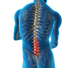 Lumbosacral spine x-ray Information - Mount Sinai - New York